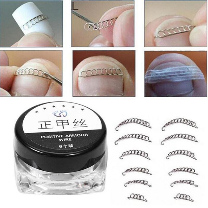 Box Ingrown Toe Nail Correction Wire Fixer Pedicure Paronychia Recover