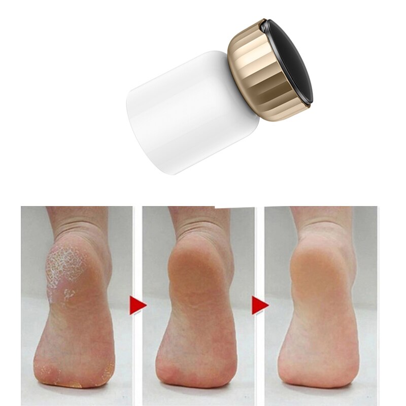 Elektrisk peeling fot förhårdnad remover peeling fotfil peeling peeling maskin fotvårdsverktyg