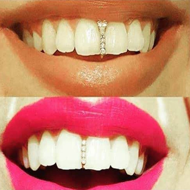 1 Pc Gold Silver Color Grillz Tooth Cap Crystal Stick Shape Top Teeth Case Rock Hip Hop Teeth Cover Grills Braces Teeth Decor