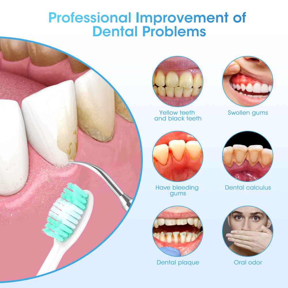 Elektrische Zahnaufhellungsbürste Sonic Zahnbürste Zahnstein Eliminator Schaber Reiniger Dental Scaler Zahnstein Steinentferner Mundpflege