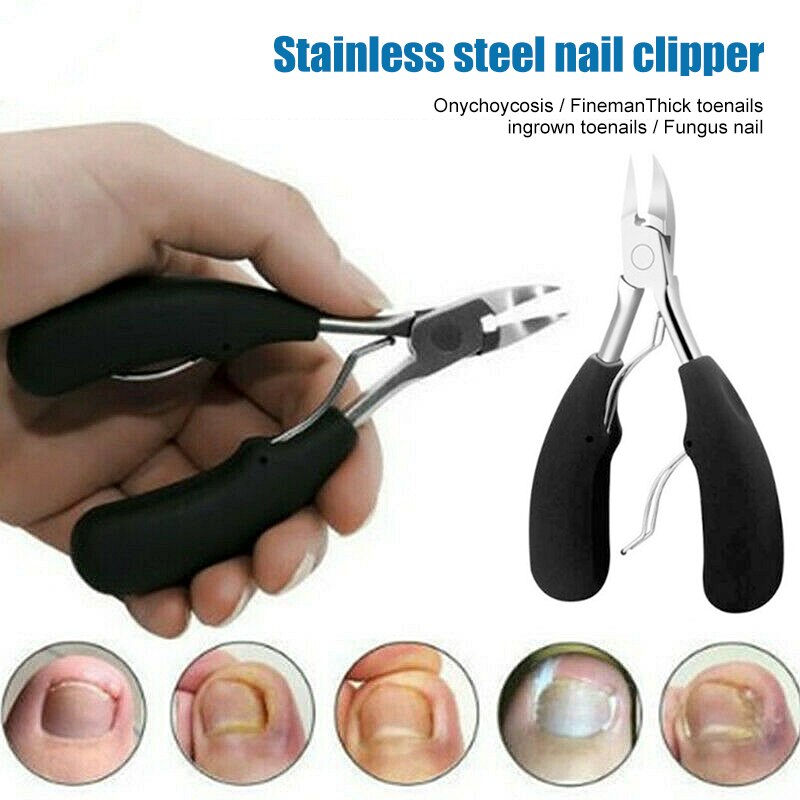 Cortauñas para uñas gruesas o encarnadas, tijeras de acero inoxidable para uñas de los pies BM88
