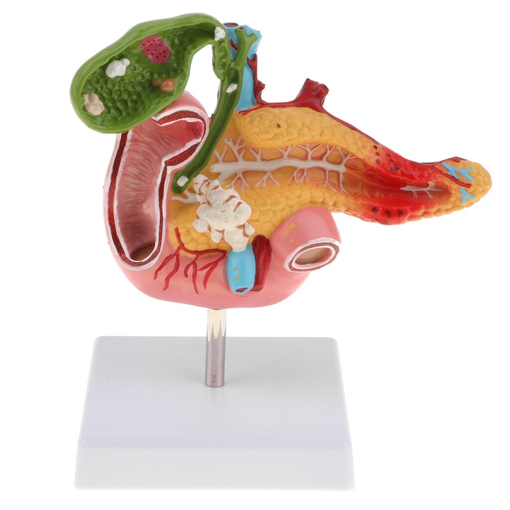 1:1 Human Pancreas Duodenum Gallbladder Pathological Anatomical Model Lab Supplies