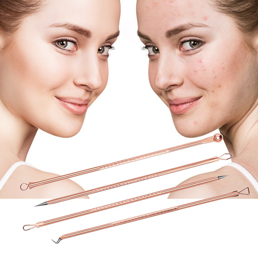 Set van 4 naalden voor het verwijderen van mee-eters, acne-clip, puistjesverwijderaar, acne-extractor voor het reinigen van mee-eters en poriën.