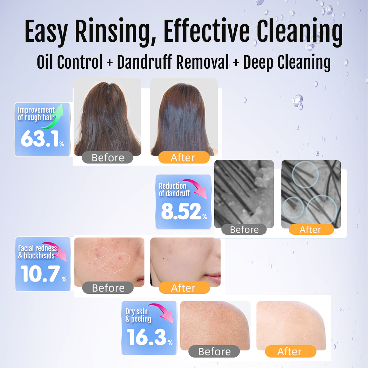 BriskSpring Micro Nano Bubble Generator G1/2 Douchefilter Diep reinigende douchereiniger Verbeter de haarhuid Badkameraccessoires