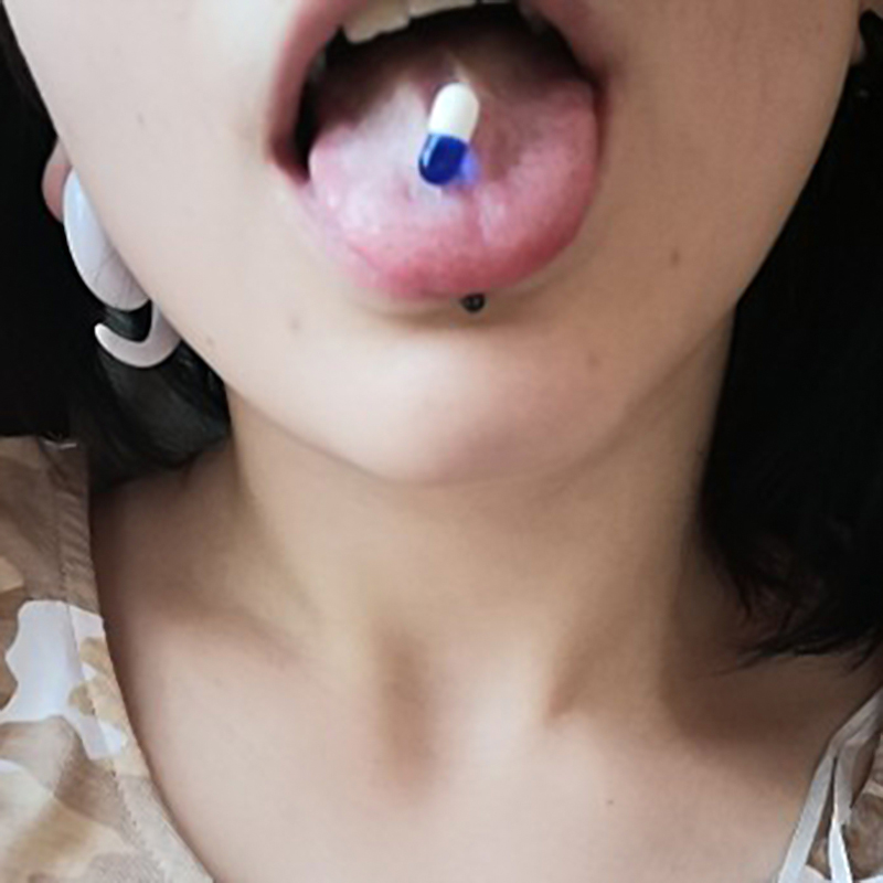 1/3PC Kleurrijke Capsule Tong Ringen Acryl Gemengde Kleur Chirurgisch Staal Tong Piercing Vrouwen Lichaam Sieraden