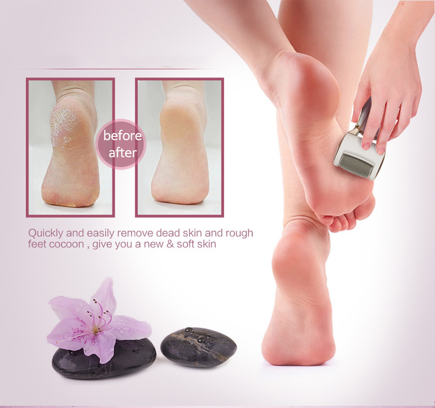 Denicer zagen elektrische pedicure exfoliator verwijderaar voetvijl eeltverwijderaar vijl voor voeten voet  + 1 extra rollerkop
