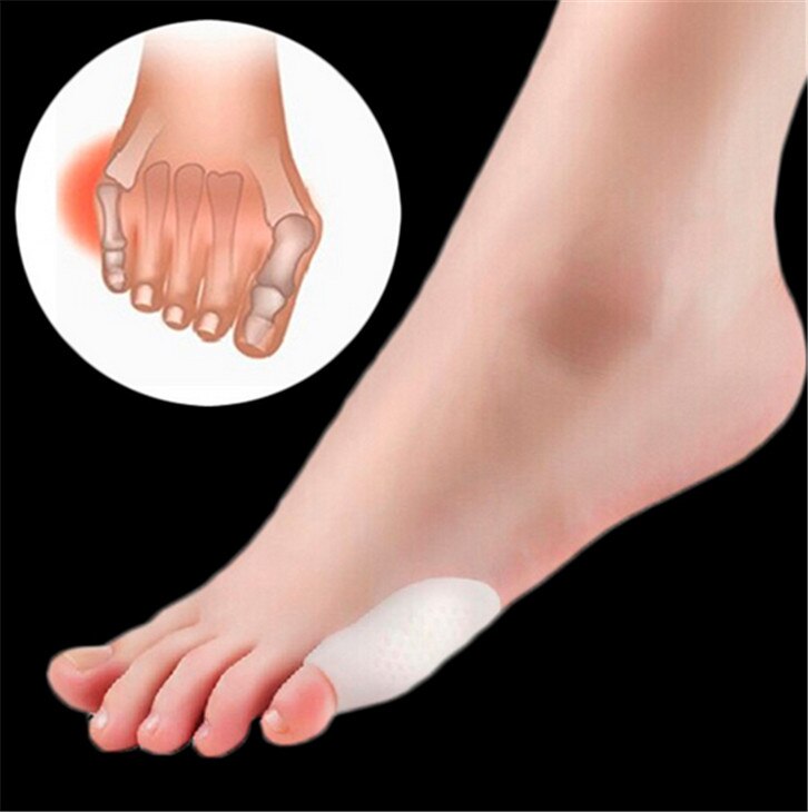 manchon d'orteil avec petit pouce Silicone Gel épandeur d'orteil griffe marteau Bunion Hallux Valgus haut talon soulagement de la douleur coussins