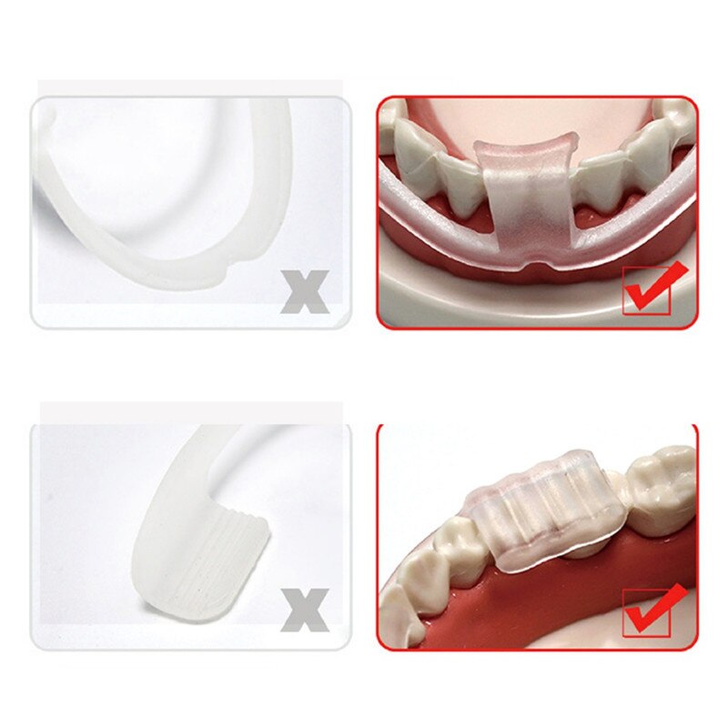 Tooth Protection Ragbi Sport Mouth Guard PVC Teeth Protector Kids Youth M... – Vicedeal
