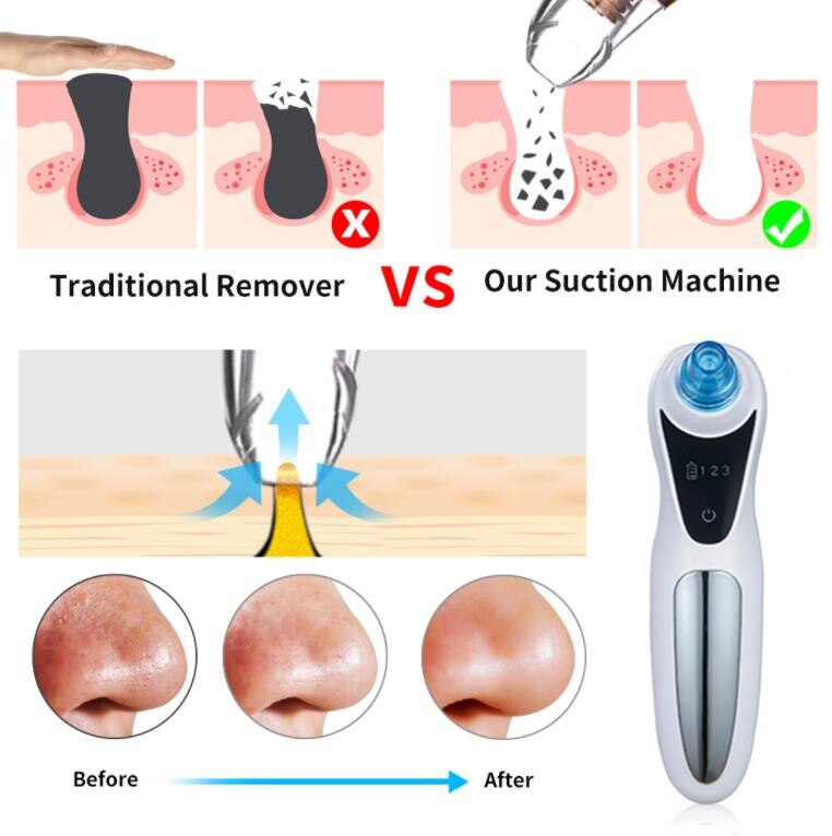 Blackhead Remover Facial Cleanser Deep Pore Removal Acne Pimples Aspiration Facial SPA Diamond Skin Care Beauty Care Tool