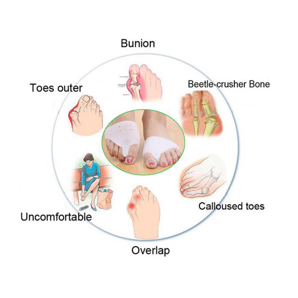 2 pièces/paire Silicone Gel pied doigts orteil séparateur pouce Valgus protecteur ajusteur garde pieds soin