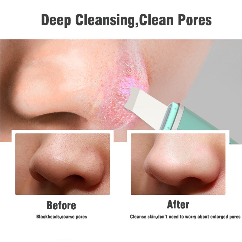 Ultrasonic Skin Scrubber Deep Cleaner Vibration Face Spatula Blackhead Remover Facial Scrubber Shovel Clean Cavitation Peeling