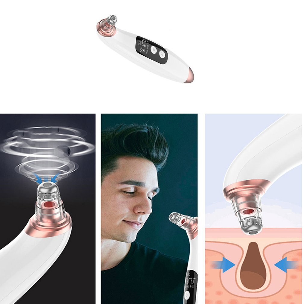 Elektrische mee-etermachine, poriënreiniger, microkristallijne mee-eters en acneverwijdering, elektronische schoonheidsmachine