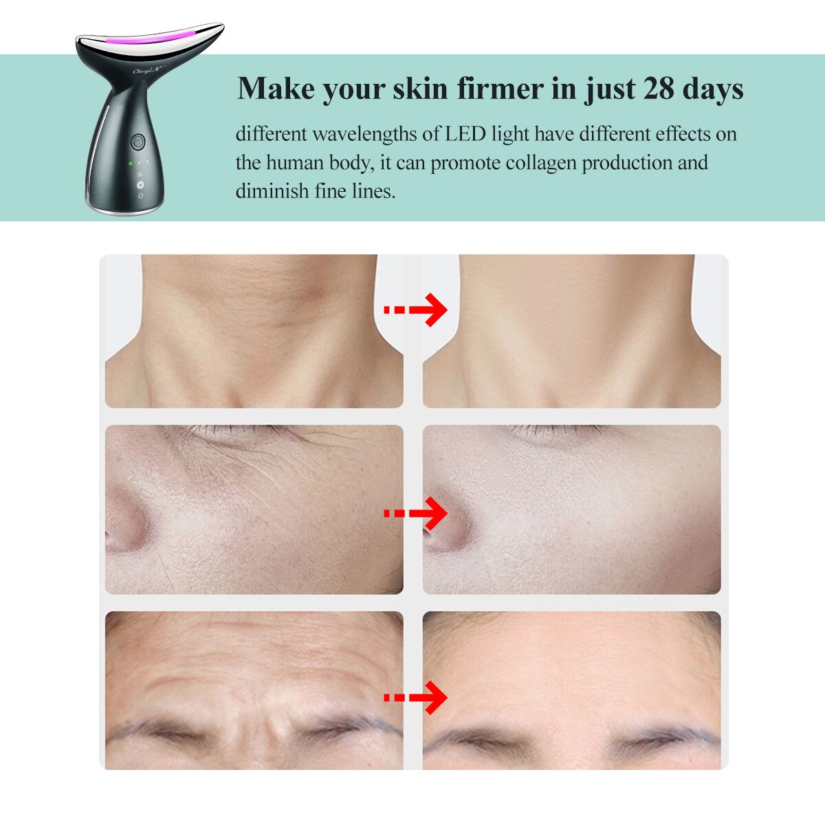 CkeyiN EMS RF LED Photon Therapy Face Lifting Machine + Led Facial Neck Massager Heating Anti Wrinkle Removal Skin Tightening