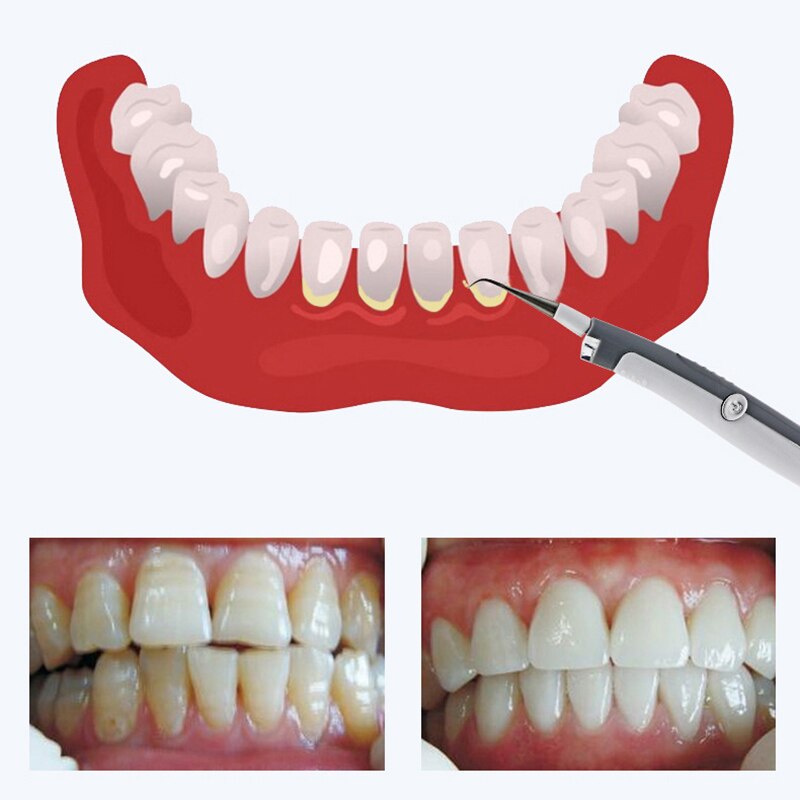 Jecdfs Fischentschupper Edelstahl - Rostfrei 23cm