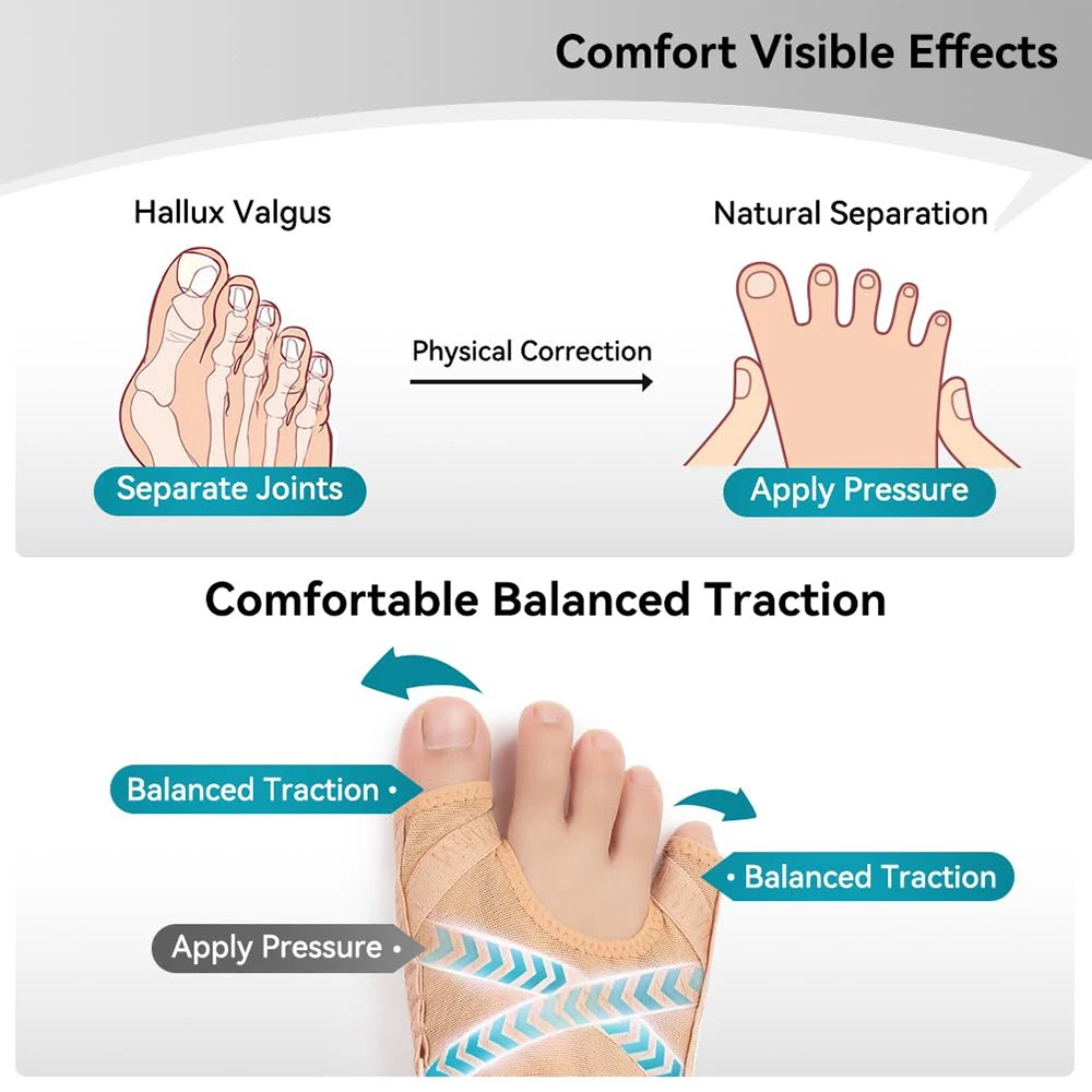 1/2/4/6/10Stck Zehenspreizer Hallux Valgus Ballen Korrektor Einstellbare Zehenspreizer Korrektor Linderung Fußschmerzen Sockenglätter