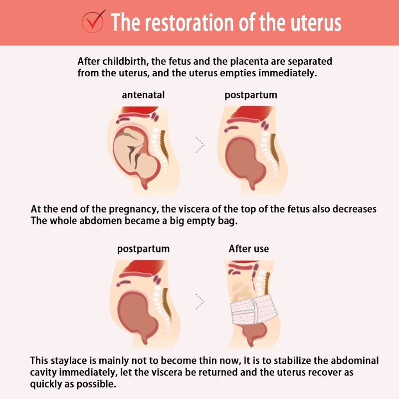 Banda de vientre para mujeres embarazadas, faja de maternidad para recuperación posparto, forma de Abdomen, DXAD