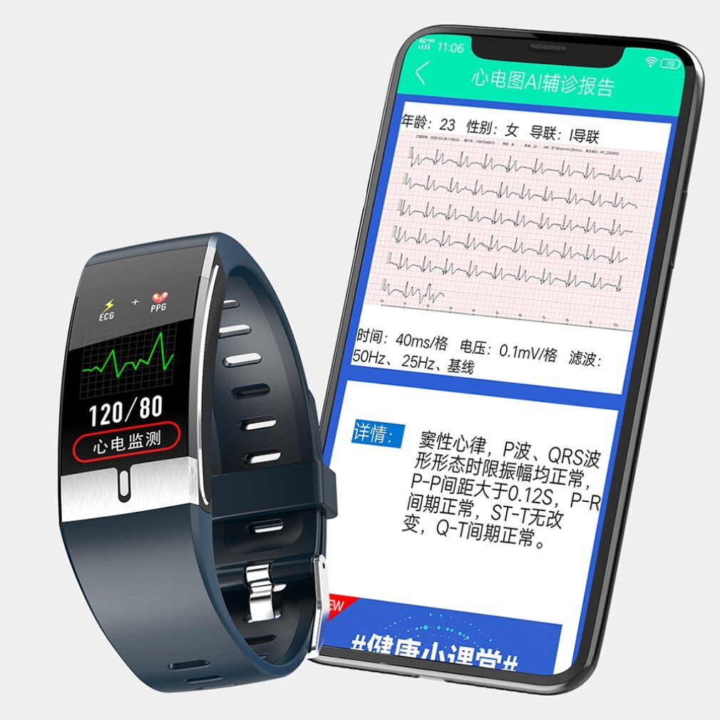 E66 Smart Bracelet Ecg + Ppg Test Bracelet Health Monitor Smart Watch Temperature Measurement Bracelet