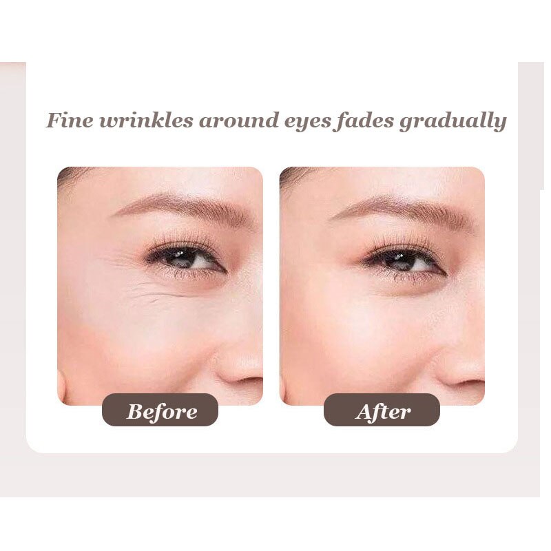 EMS dispositivo de belleza Facial LED, luz azul roja, masaje Facial vibratorio, cuidado de los ojos, ION de limpieza, estiramiento de la piel, masajeador para cuidado Facial ajustado