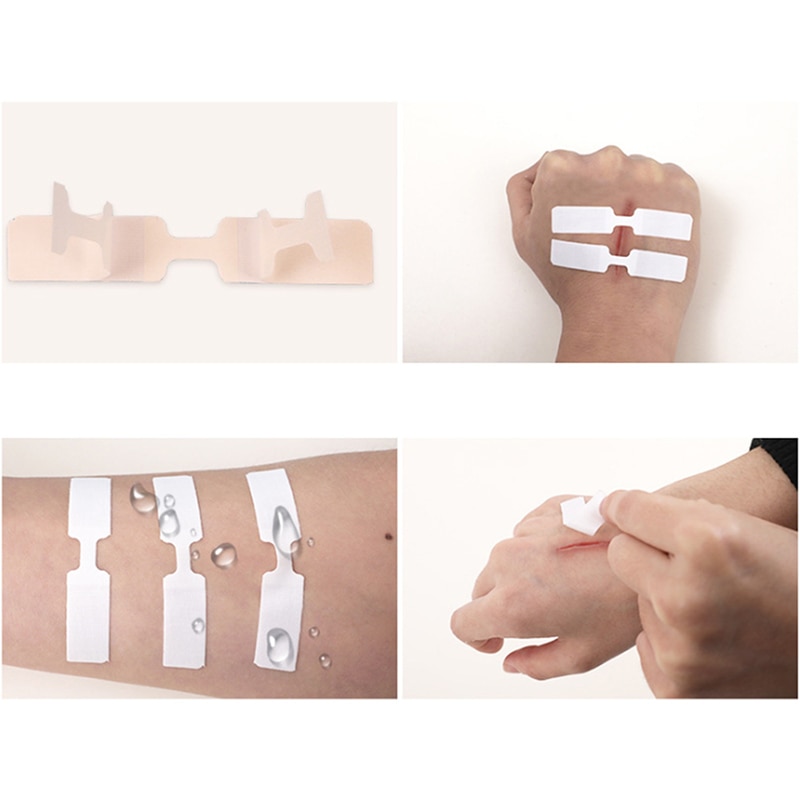 10 Stks/doos Waterdichte Pleister Vlinder Lijm Wond Sluiting Band Aid Emergency Kit Lijm Bandages