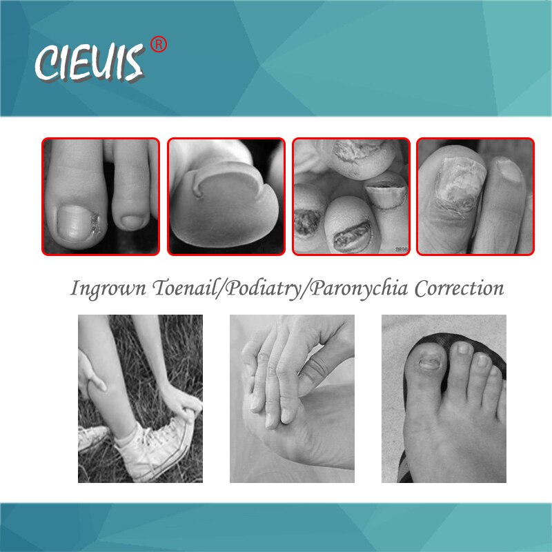 Cortaúñas para manicura y pedicura, tijeras profesionales para cutículas, pinzas para uñas encarnadas, herramienta de corrección de Podología