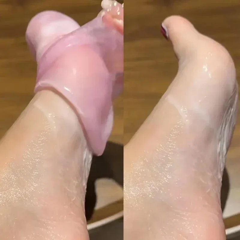 Chaussettes en silicone anti-Contation pour les pieds, 1 à 5 paires, respirantes, exextensibles, gel, suppression de la fréquence, hydratant pour la peau, outil de massage des pieds