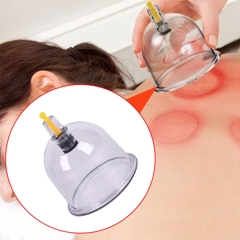 1 Stück Vakuum-Schröpfglas für Massage, Chinesische Medizin, Physiotherapie, Anti-Zellulitis Saugnapf, Körpermassagegerät für Gesundheitspflege