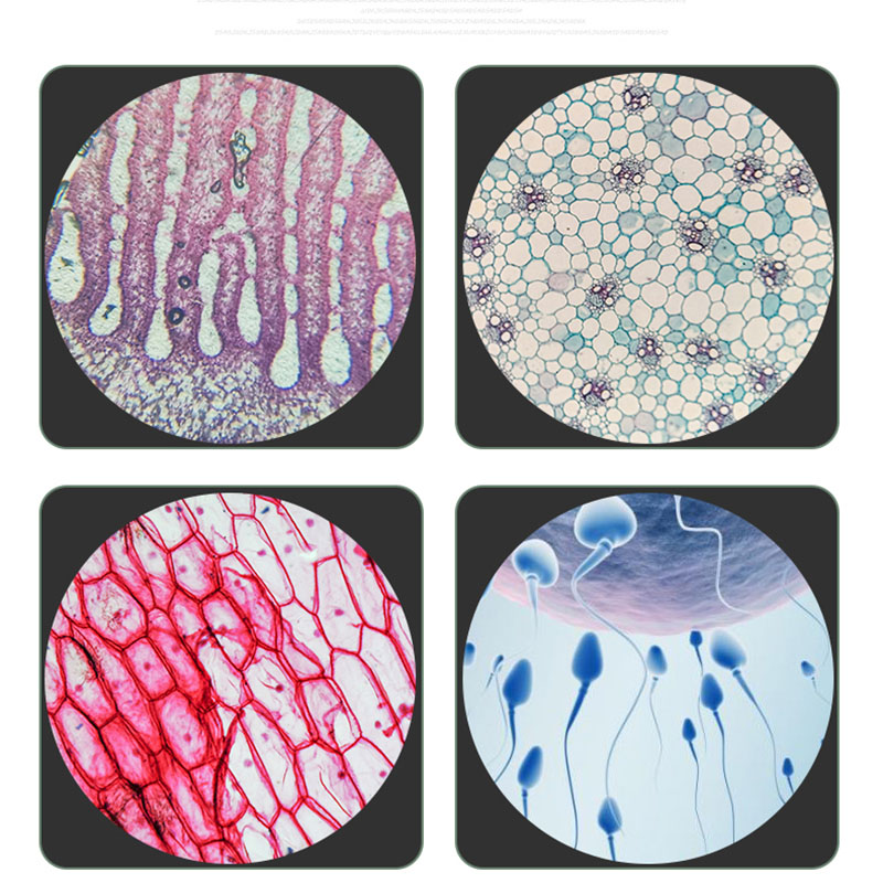 Lente objetivo acromática 4X 10X 20X 40X 60X 100X 195 mm distancia del tubo longitud 160 mm objetivo de microscopio biológico