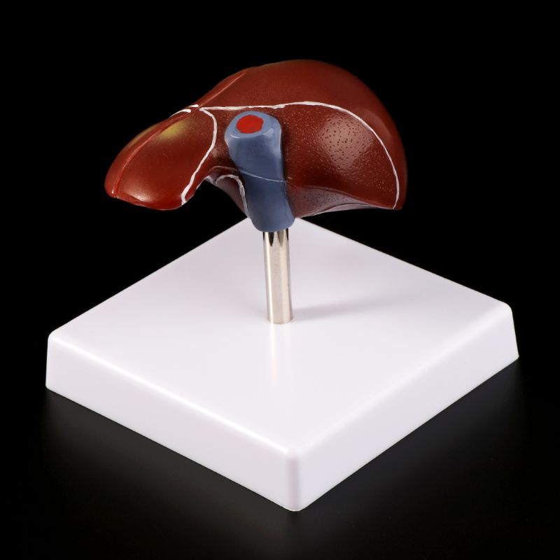 Modelo anatómico patológico del hígado humano, herramienta de exhibición para enseñanza escolar de anatomía, equipo de laboratorio L29K