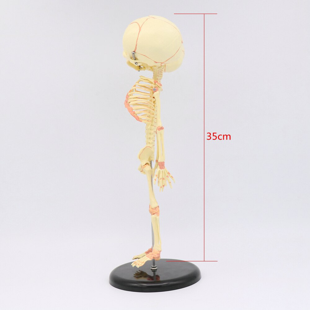35CM crâne à deux têtes humain -né bébé Double tête anatomie crâne squelette anatomique éducation cérébrale modèle d'étude anatomique
