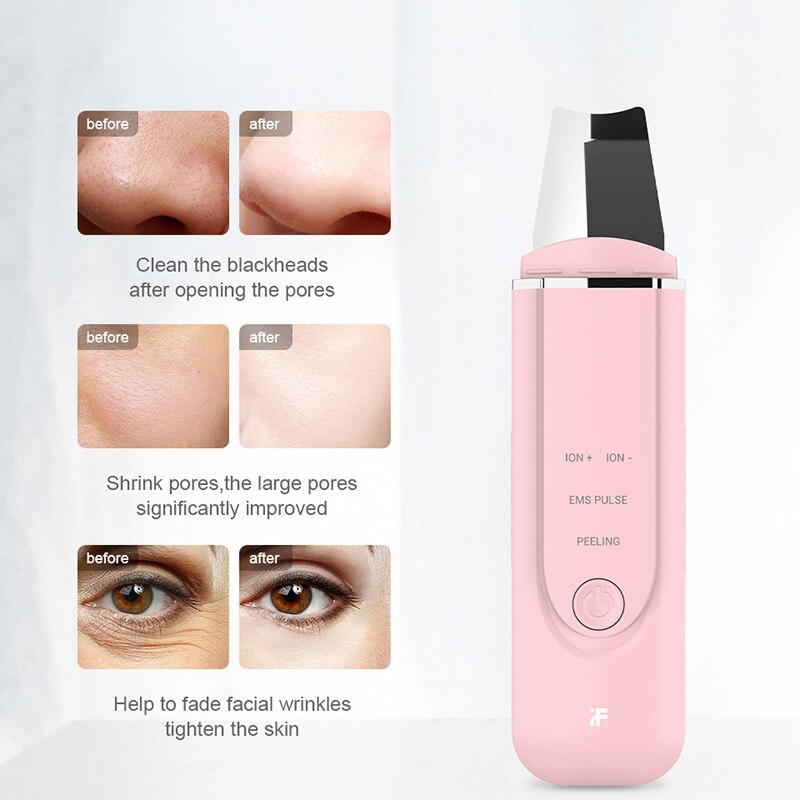 Xiaomi Inface Facial Cleansing Brush Vacuum Blackhead Remover Ultrasonic Ion Cleansing Skin Scrubber