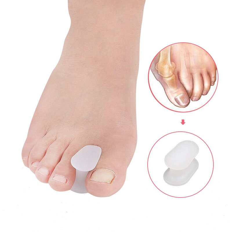 1-7Pair Foot Care Tools Silicone Gel Toe Spacers Separators Thumb Device Pad Overlapping Bunion Corrector Pedicure Orthosis