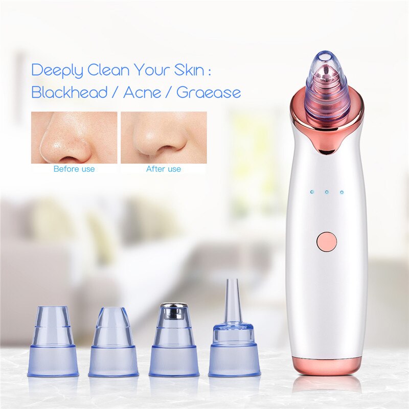 Blackhead Remover Pore Vacuum Cleaner Upgraded Blackhead Vacuum Rechargeable Face Vacuum Comedone Extractor Tool for Blackhead
