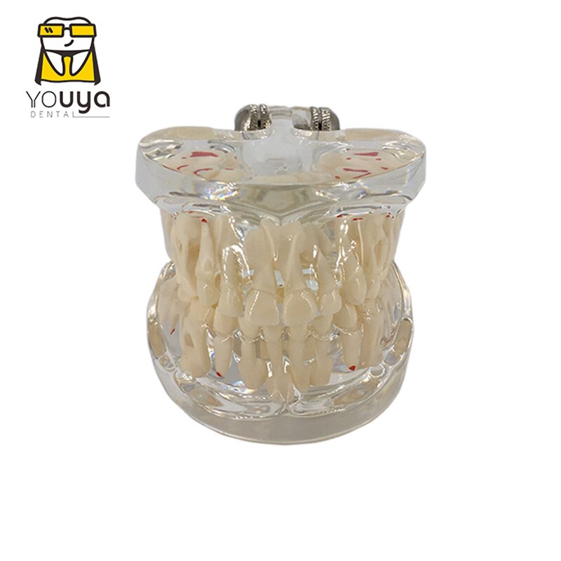 Dental Model For Children Deciduous Tooth Permanent Teeth Alternating Study Teathing Pediatric Dental Pathology Preventive Model: D