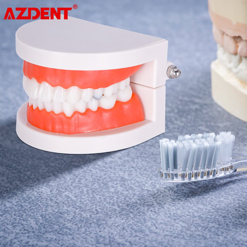 Dental Teeth Model Tooth Decay Model PVC School Teaching Equipment