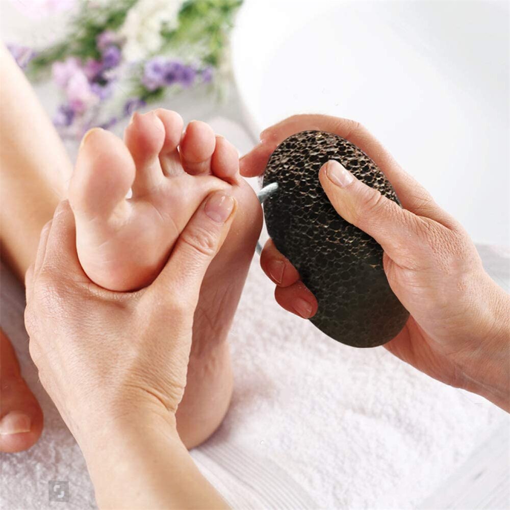 Pumice 2 Pack Natural Earth Lava Stone Pedicure Kit Tool Hard Skin Callus Remover for Feet and Hands Warts Corn Removal