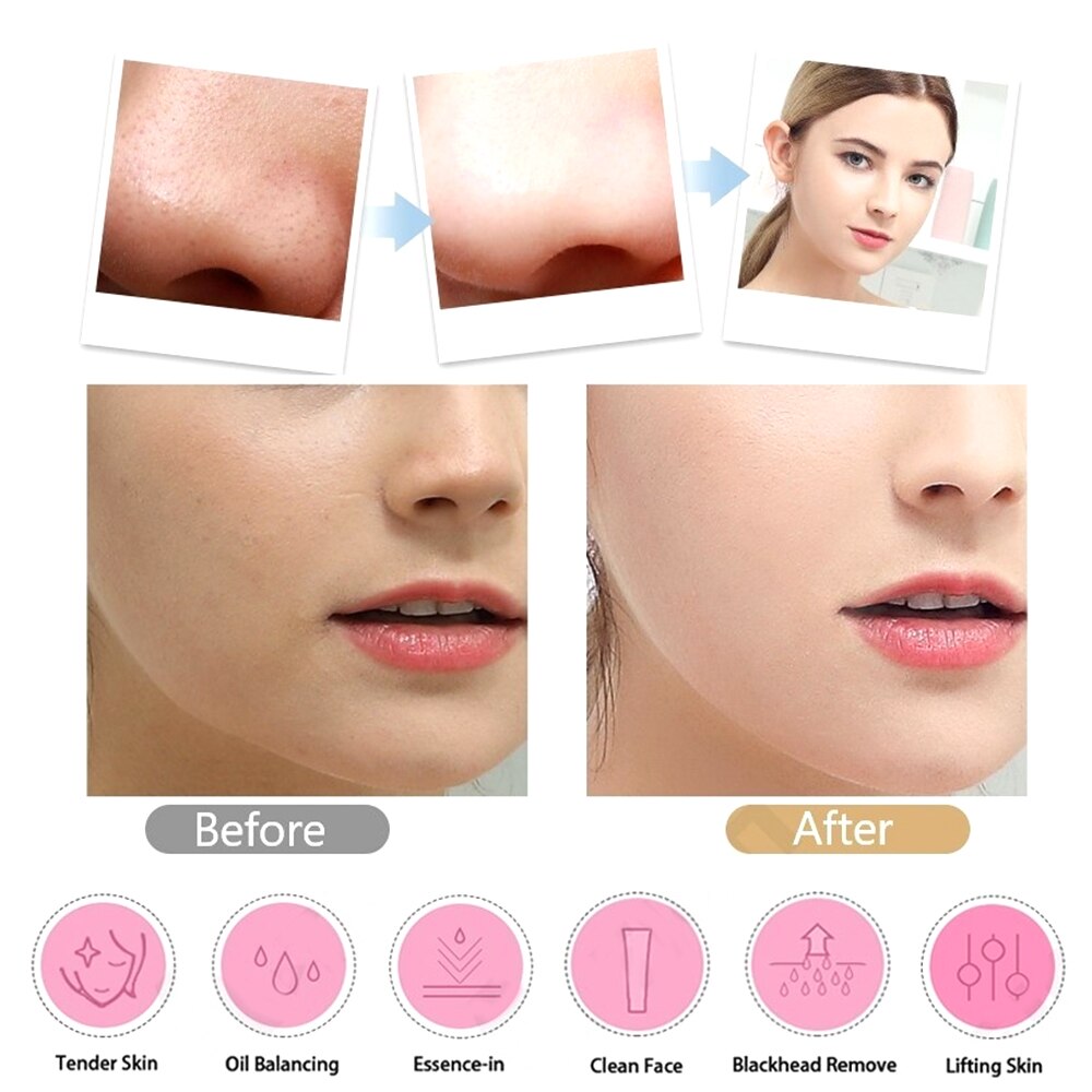 Skin Scrubber Facial Skin Scrubber Electric SPA Gentle Blackhead Remover Ultrasonic Facial Cleaner Spatula Face Lifting Massager