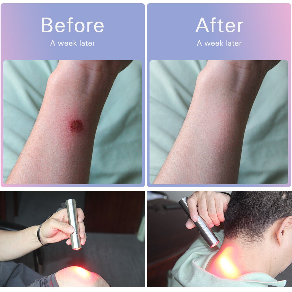 Portable red light therapy 670nm Class II LED therapy light 630nm 850nm for skin rejuvenation beauty machine