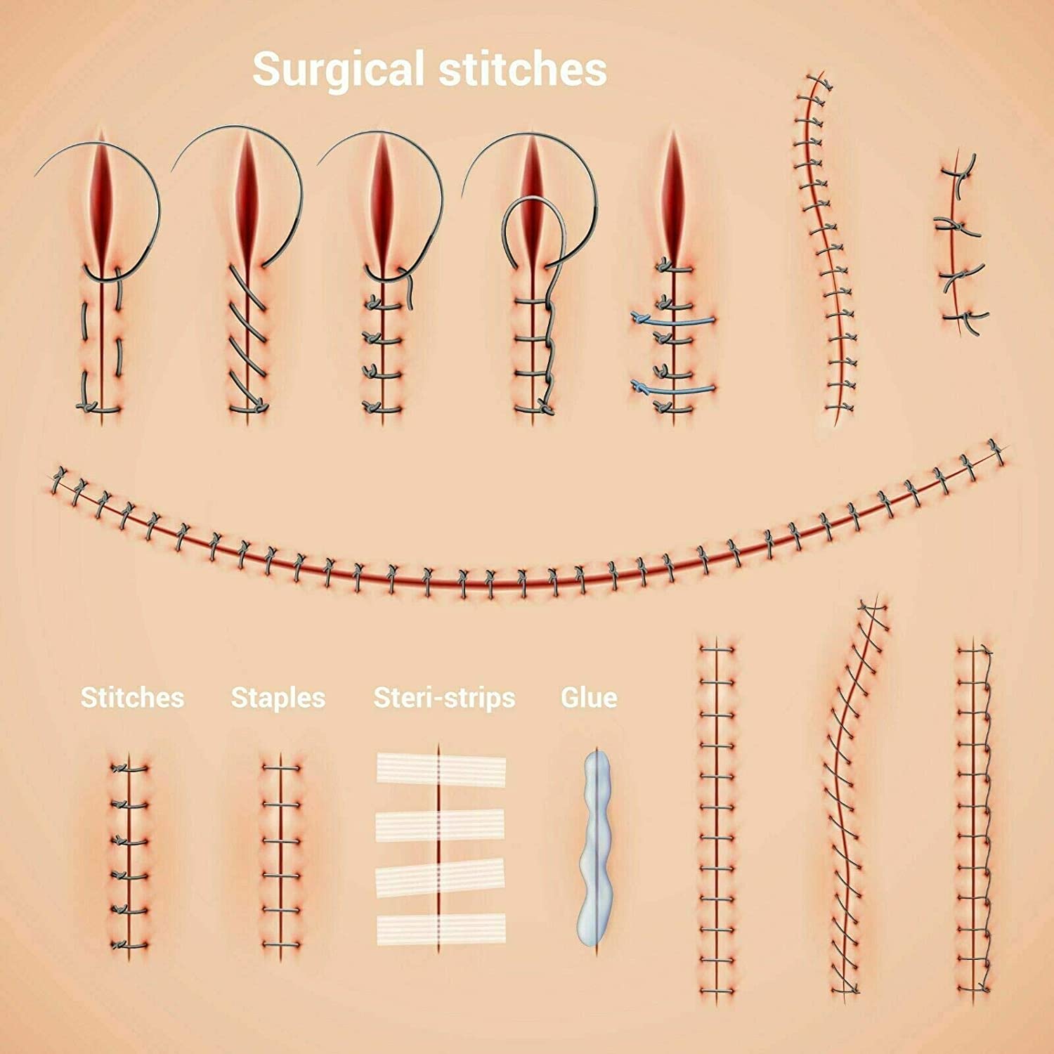Kit médical de formation à la Suture, modèle de peau, entraînement à la pratique de la Suture humaine, Kit de formation pour médecins et infirmières