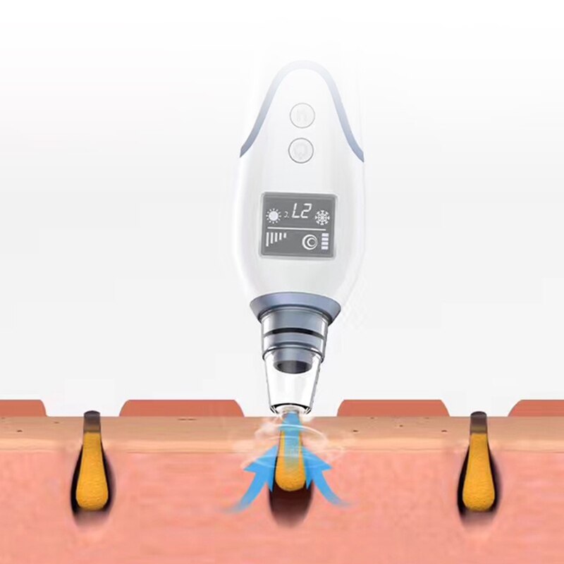 2 in 1 Multi-Functional Ice Compress Blackhead Remover Vacuum Suction Face Pimple Acne Extractor Facial Pores Cleaner Skin Tools