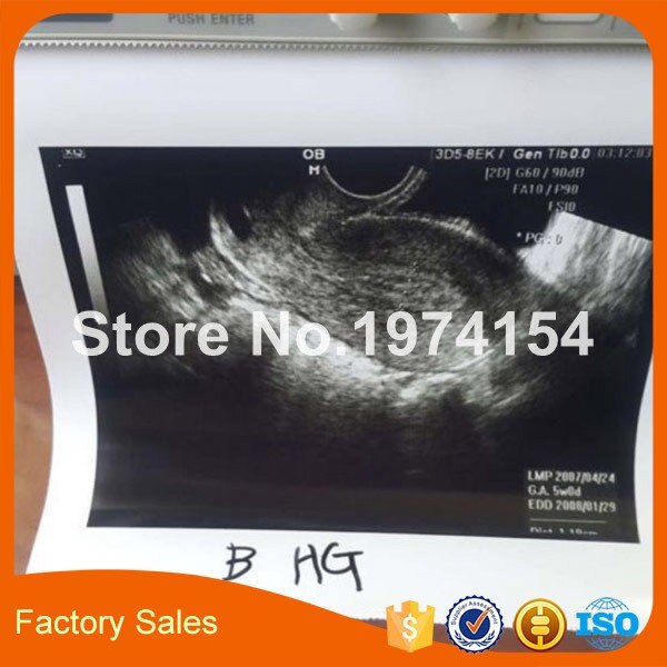 1 roll UPP-110HG White Thermal Print Paper Pack for UP-897M,UP-D897MD,UP-895MD,UP-D895MD,UP-890MD black/white video printer