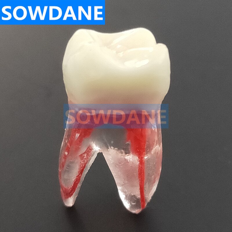 1:1 résine endodontique dentaire étudiant étude pratique modèle d'opération Transparent sans fichiers