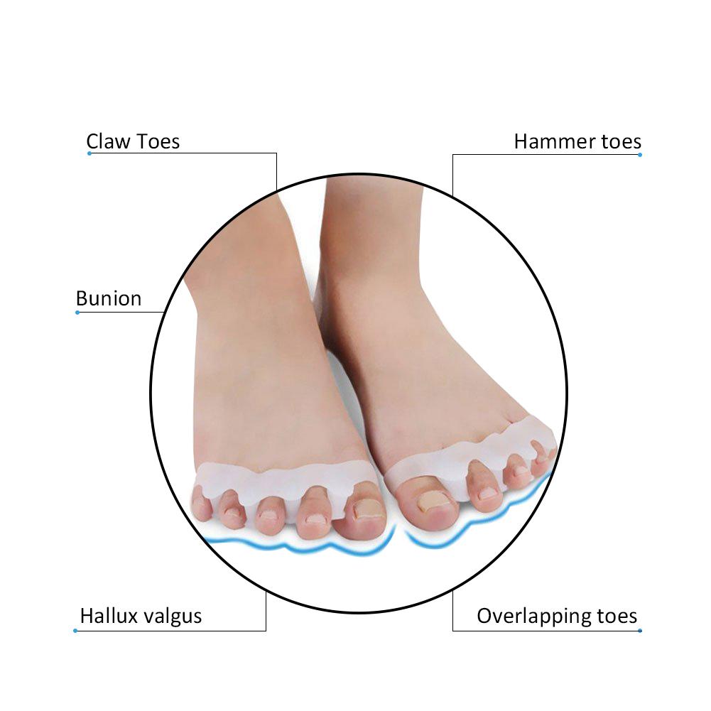Siliconen Teen Valgus Teen Separator Kind Teen Aligner Teen Brancard Voor Mannen En Vrouwen Schoenen