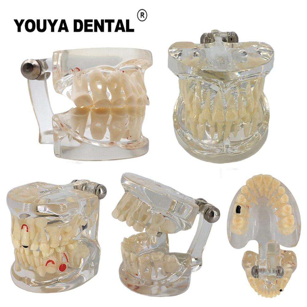 Dental Teaching Model Children Deciduous Tooth Permanent Teeth Alternating Study Pediatric Dental Pathology Preventive Model
