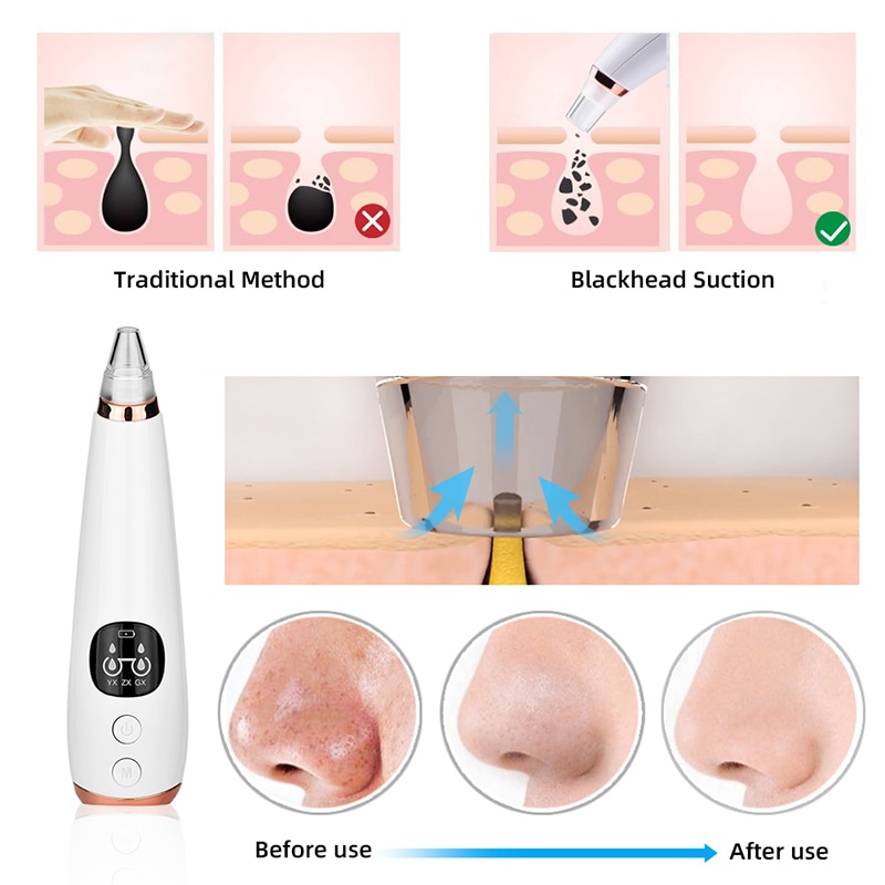 Electric Acne Remover Point Noir Blackhead Vacuum Extractor Tool Black Spots Pore Cleaner Skin Care Facial Pore Cleaner Machine