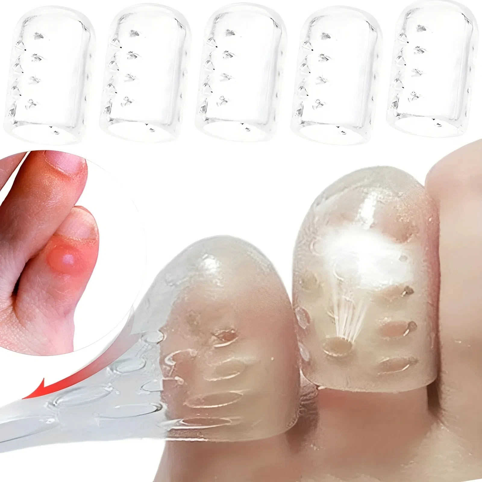 Embout de doigt en Silicone, 10 pièces, couverture de protection, manchon de pouce, ampoules de maïs, soulagement de la douleur, Tube d'orteil, Correction d'oignon, soins des pieds