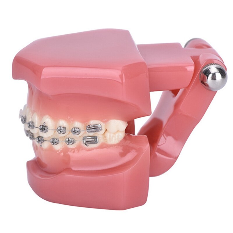 Teeth Model Implant Disease Teeth Model Dentist Studying Model