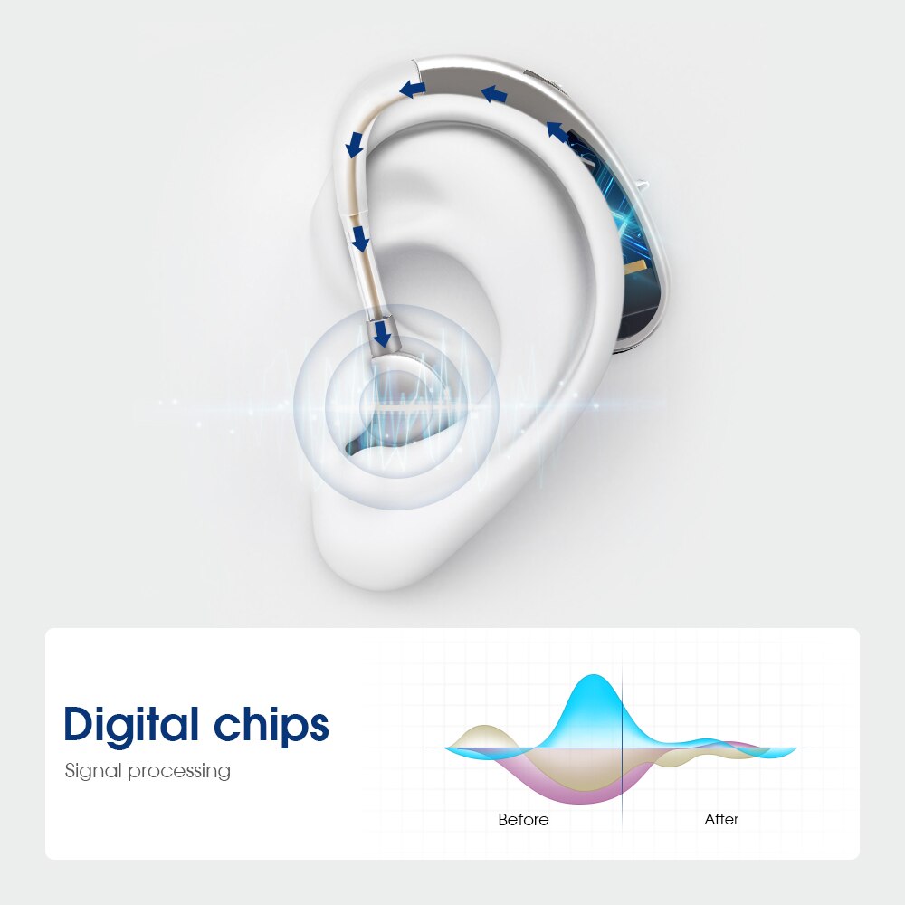 Rechargeable Hearing Aid,Mini Wireless Digital Invisible Sound Amplifier,Suitable For People With Moderate To Severe Hearing