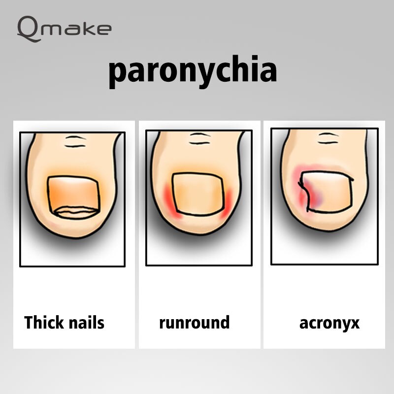 Nueva cortadora de uñas, alicates para las uñas de los pies para las cutículas, alicates para la tijera de recorte, herramienta de manicura y pedicura de acero inoxidable