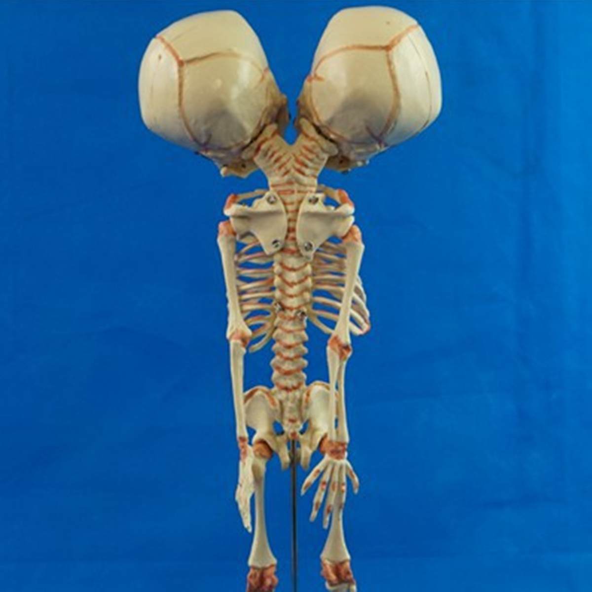37 cm humain nouvelle Double tête bébé anatomie crâne squelette anatomique cerveau anatomie éducation modèle anatomique étude affichage