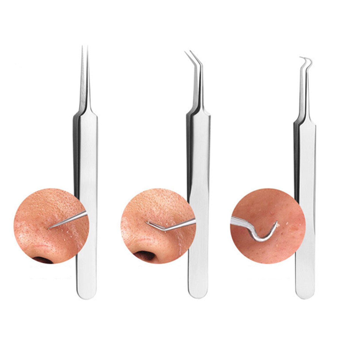 8X Blackhead Whitehead Pimple Spot Comedone Acne Extractor Remover Blemish Tool